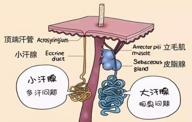 狐臭是怎么产生的？到底是疾病还是生理现象，该怎么根除？