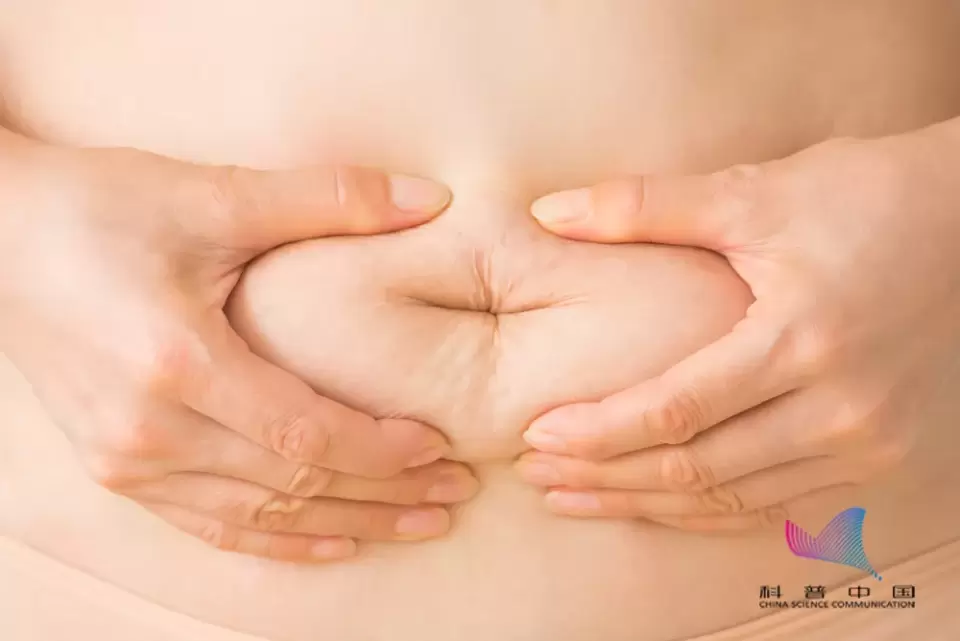 触目惊心！一女子体内竟取出400颗结石！这个习惯很多人都有